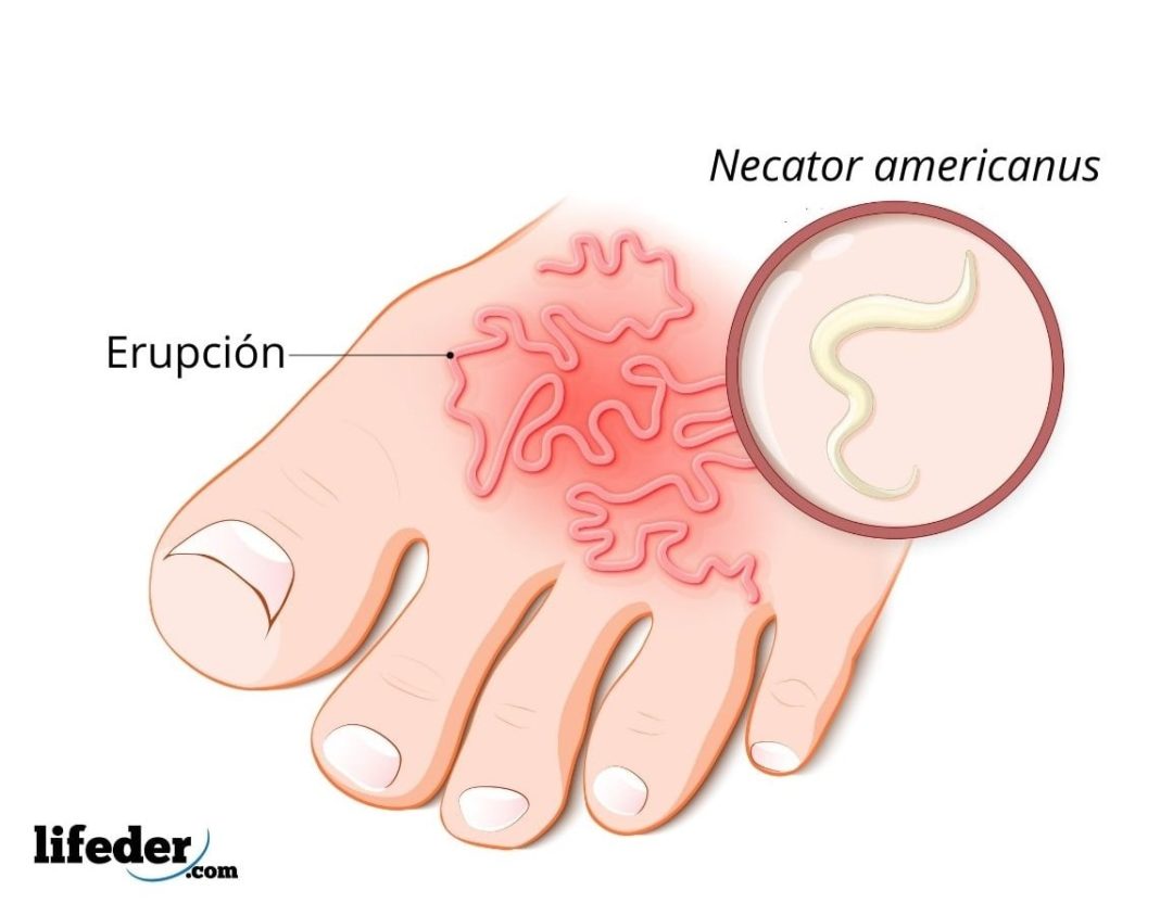 Necator americanus características, ciclo de vida, enfermedades