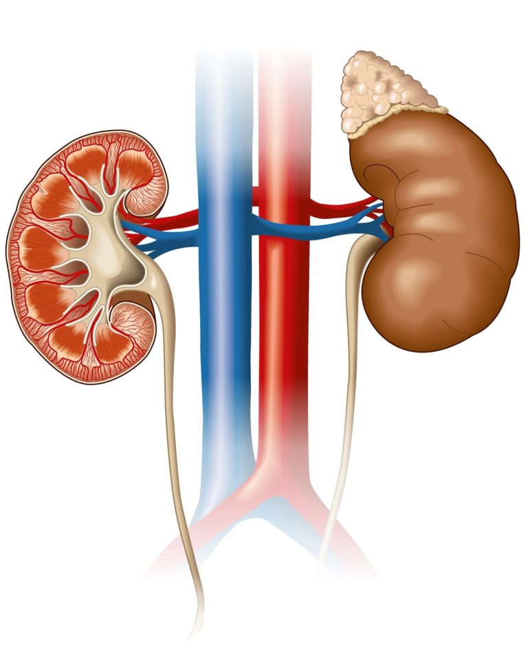 Riñones: partes, funciones, funcionamiento, enfermedades