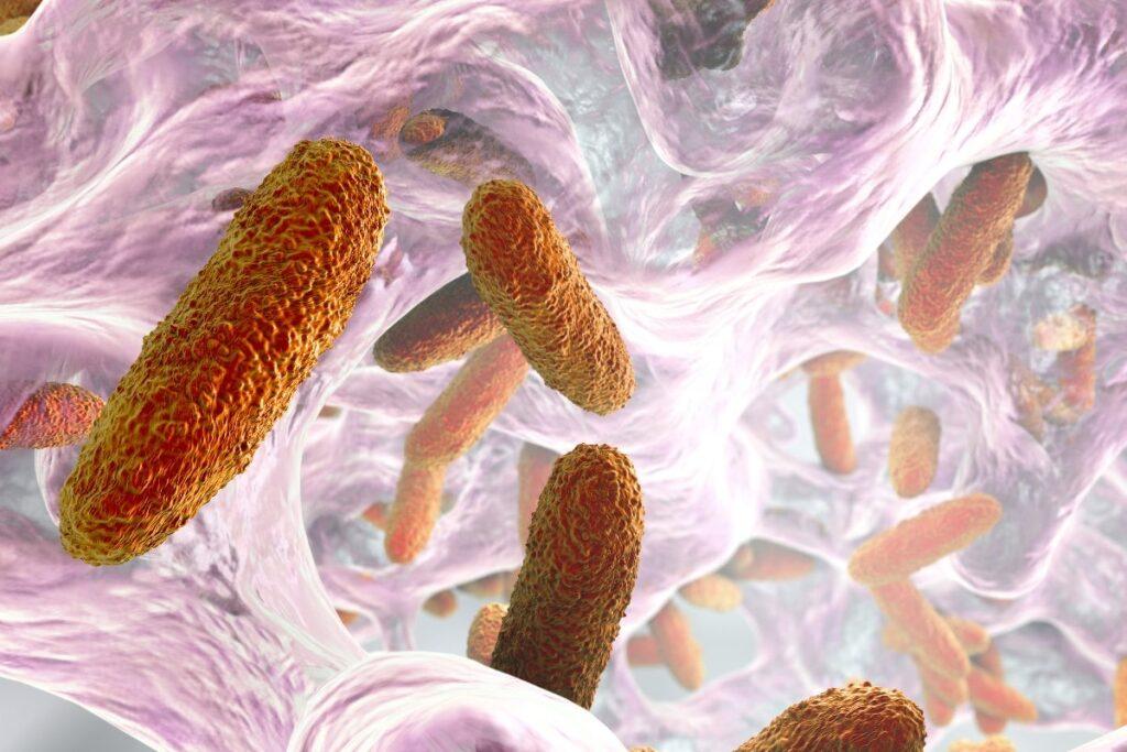 Klebsiella pneumoniae qu es caracter sticas morfolog a enfermedades