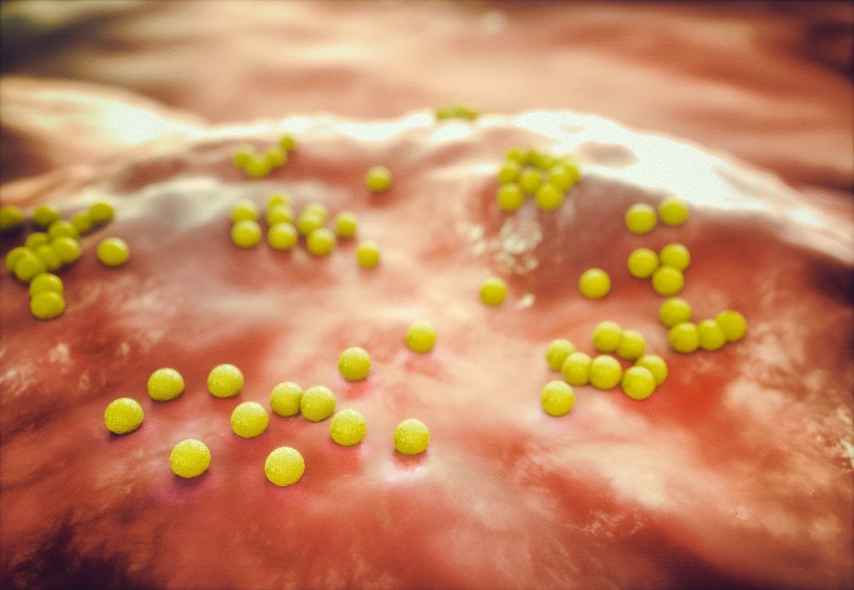 Staphylococcus aureus qu es caracter sticas taxonom a morfologia