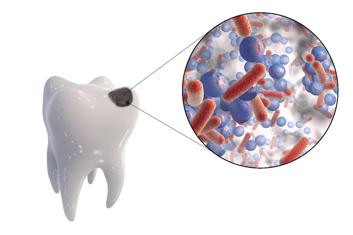 Микроорганизмы полости рта. Бактерии стрептококк мутанс.