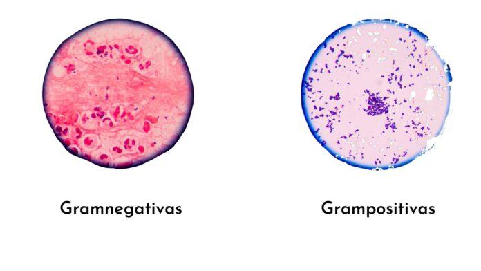 Cocos gram positivos: qué son, morfología, estructura, patógenos