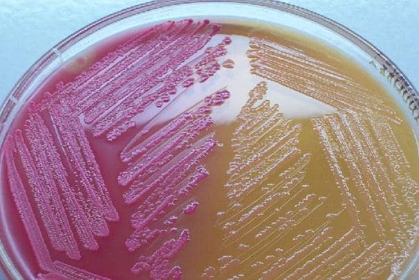 Agar MacConkey: fundamento, preparación y usos