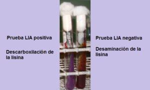 Agar LIA (lisina hierro)