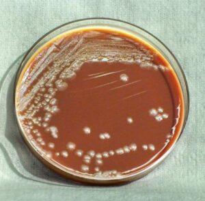 Agar chocolate