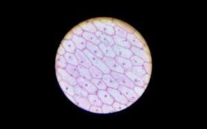 Epidermis de la cebolla