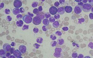 Tinción de May Grünwald-Giemsa