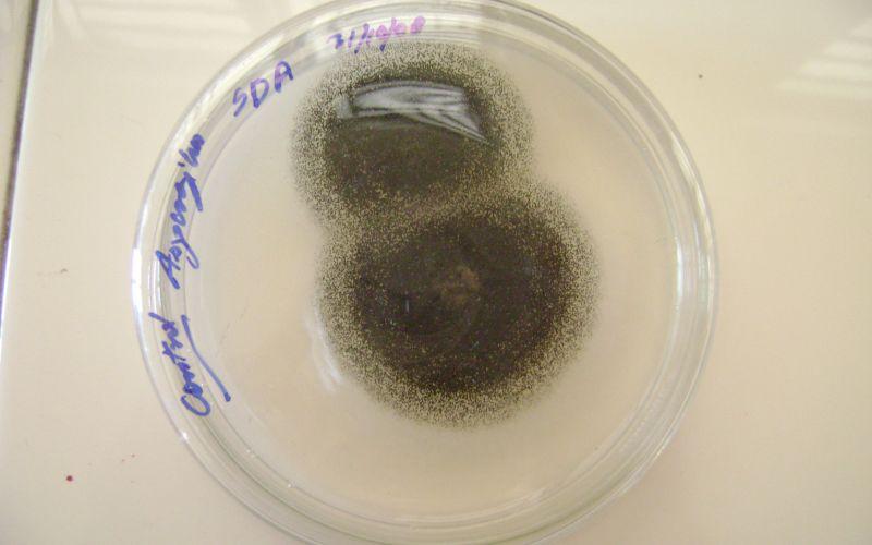 Agar Sabouraud qué es, fundamento, preparación y usos