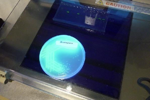 Agar cetrimida con fluorescencia.