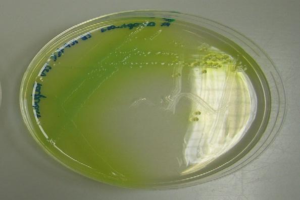 Agar cetrimida