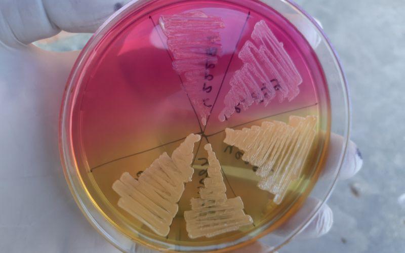 Agar sal y manitol qué es, fundamento, preparación, usos Agar sal y manitol qué es, fundamento, preparación, usos