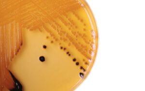 Agar Salmonella-Shigella