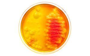 Agar verde brillante