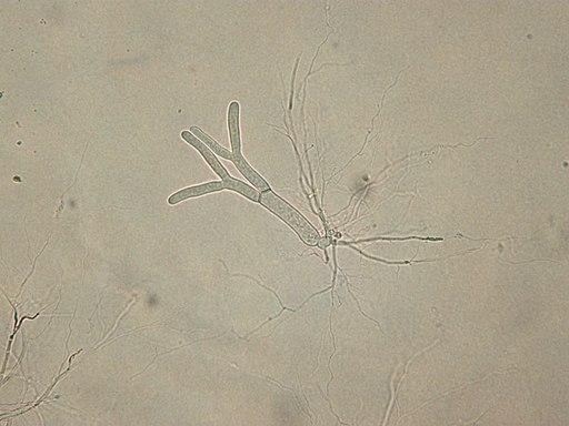 Chytridiomycota: características, ciclo de vida y hábitat - Lifeder