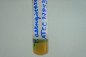 Caldo soya tripticaseína