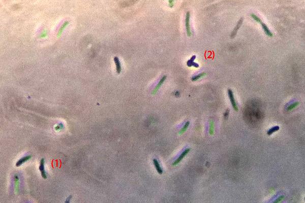 Proteus Mirabilis Cell Morphology