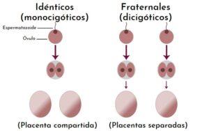 Gemelos univitelinos