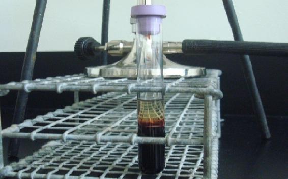 Separación del Plasma Plasma