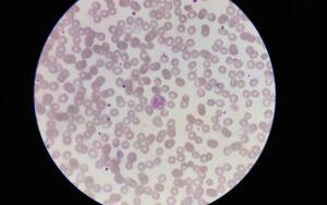 Buffer de fosfatos (PBS)