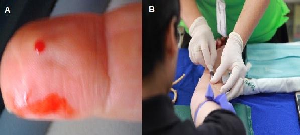 Toma de muestras sanguíneas