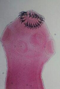 Taenia solium
