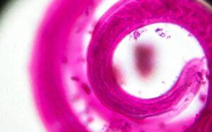 Trichinella spiralis