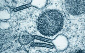 Células de Langerhans