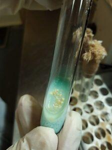 Medio Löwenstein-Jensen