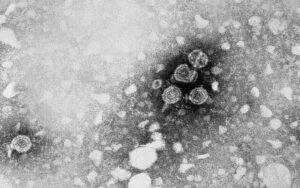 Hepadnavirus