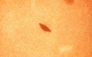 Streptococcus salivarius