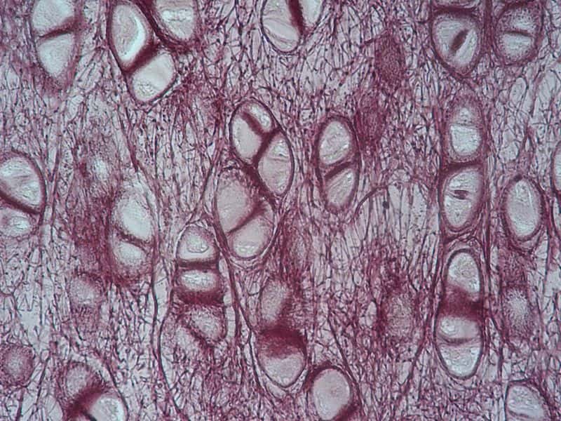 Cartílago elástico: características, histología, funciones