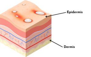 Epidermis