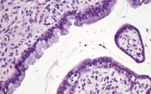 Epitelio cilíndrico