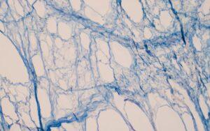 Tejido conectivo laxo