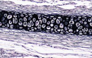 Cartílago elástico