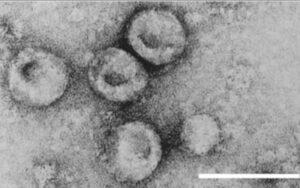 Diarrea viral bovina