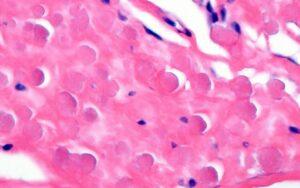 Tinción de hematoxilina-eosina