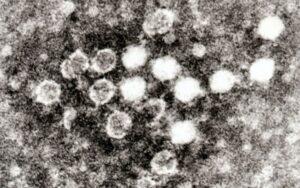Virus ADN monocatenario