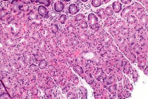 Células parietales: características, histología, funciones, enfermedades