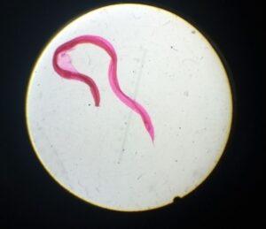 Ancylostoma duodenale