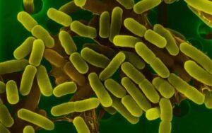 Bacilos gramnegativos