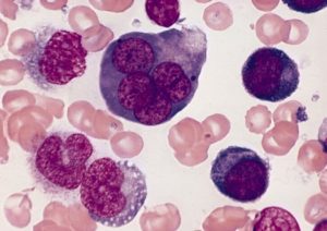 Eritroblastos: qué son, eritropoyesis, patologías asociadas
