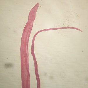 Tremátodos: características, especies, contagio, síntomas