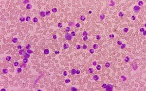 Enfermedades de la médula ósea