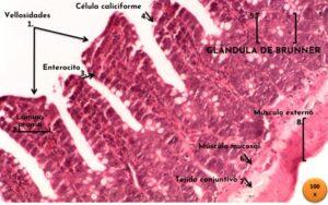Glándulas de Brunner