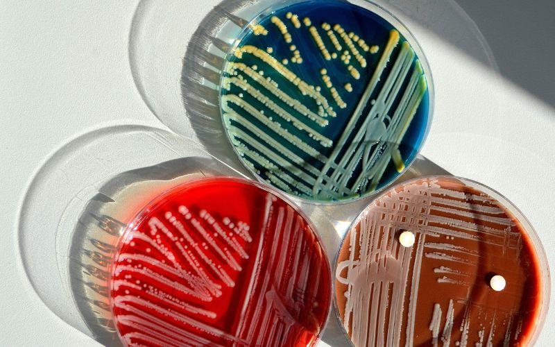 Cultivo de bacterías: qué es, características, tipos, métodos, ejemplos