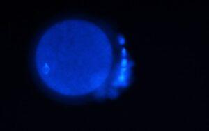 DAPI (4’, 6-diamidino-2-fenilindol)