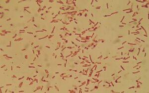 Shigella sonnei