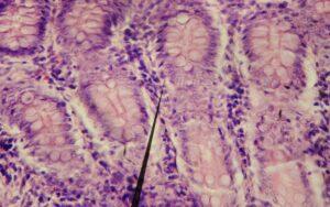 Criptas de Lieberkühn