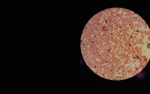 Aggregatibacter actinomycetemcomitans